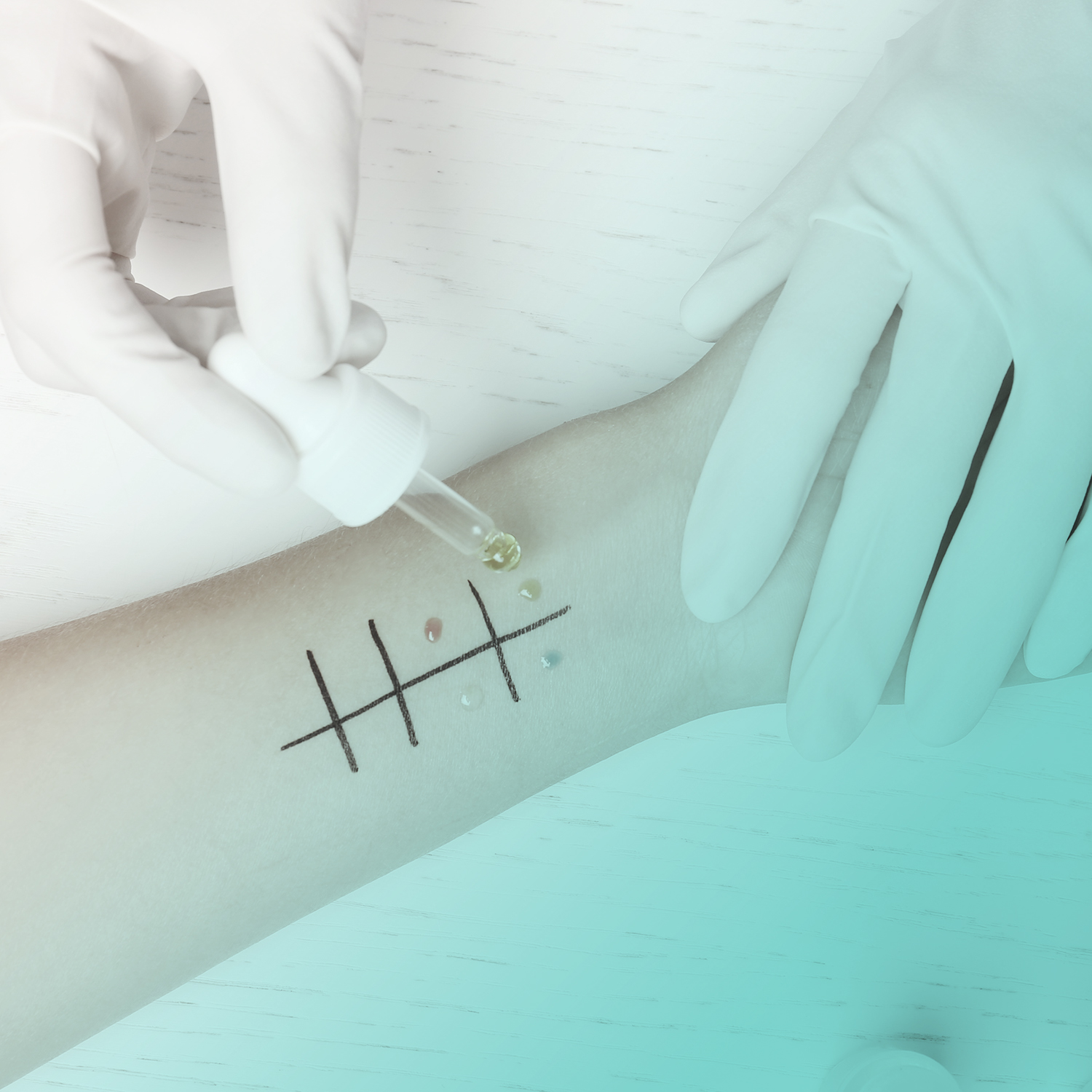 ALLERGOLOGIA e IMMUNOLOGIA CLINICA al J|medical