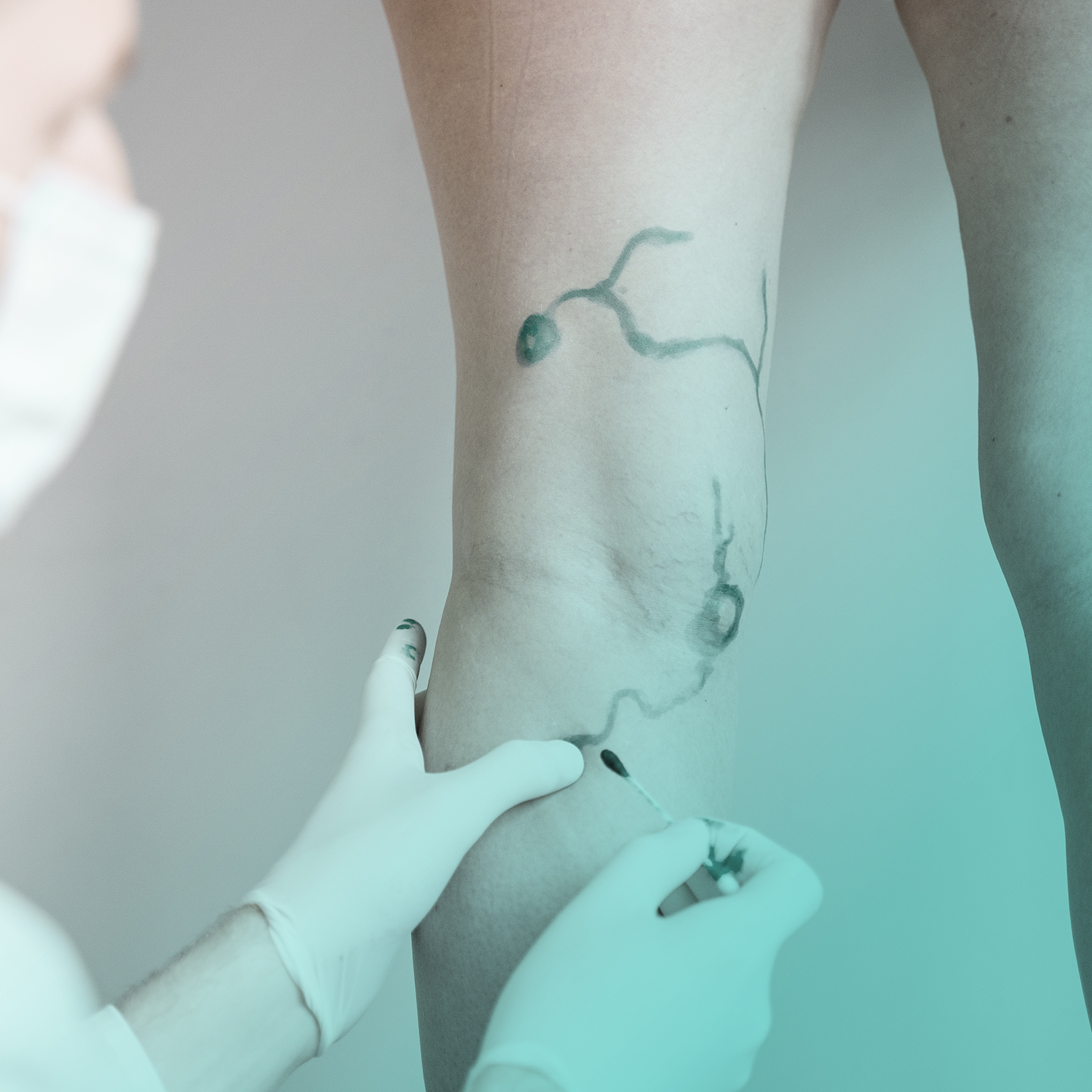 ANGIOLOGIA e CHIRURGIA VASCOLARE al J|medical