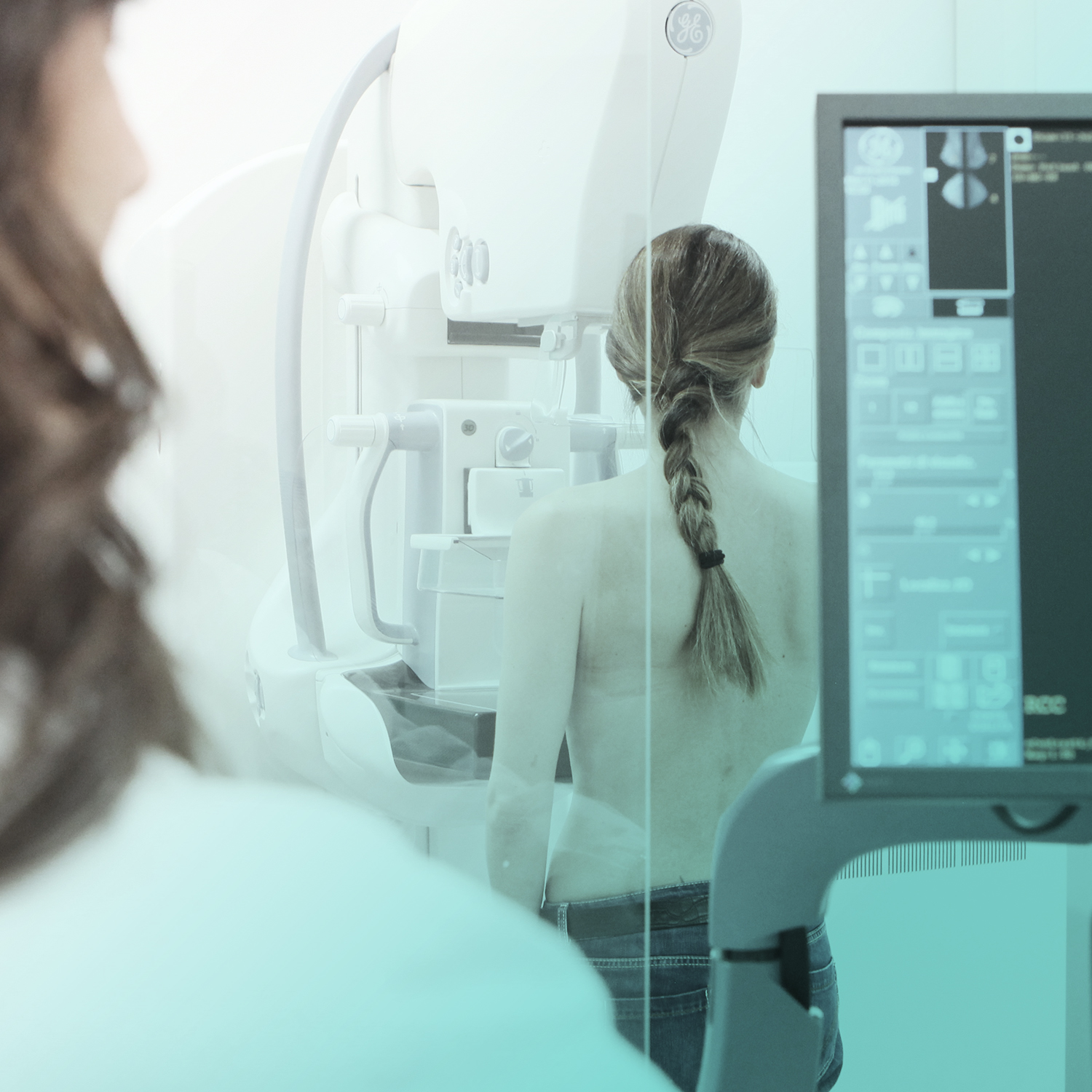 RADIOLOGIA SENOLOGICA al J|medical