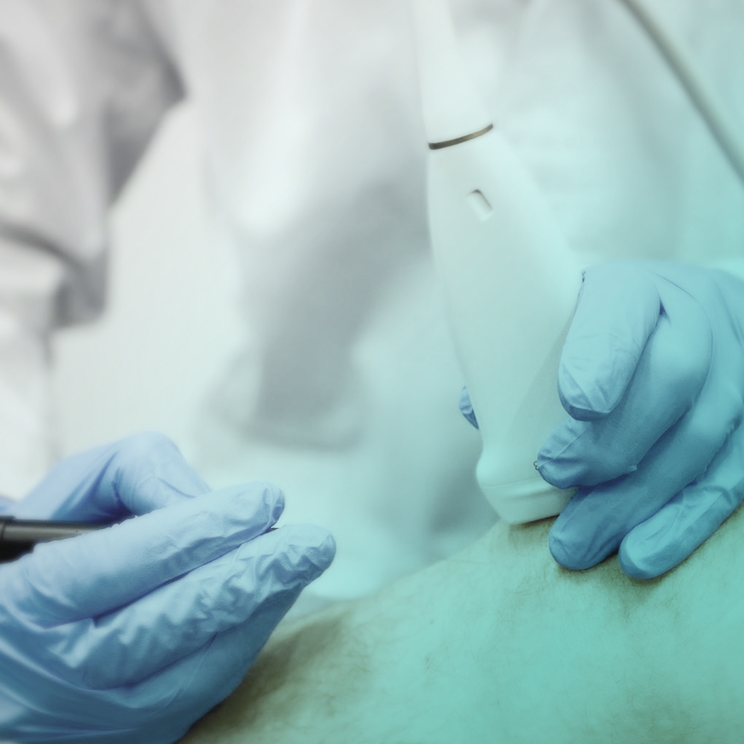ELETTROLISI PERCUTANEA ECOGUIDATA e NEUROMODULAZIONE al J|medical